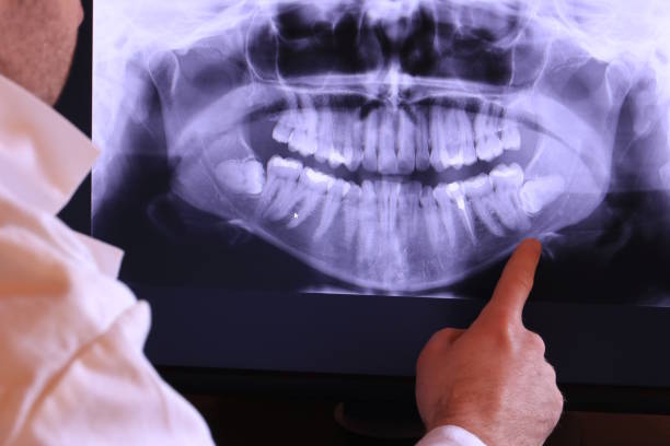 Best Emergency Treatment for Oral Infections in Goleta, CA